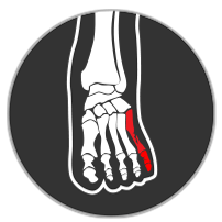 ankle 5th metatarcel icon