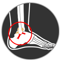 ankle sprain icon