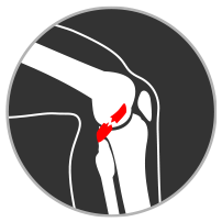 ligament tear icon