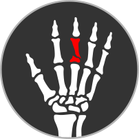 hand fracture icon