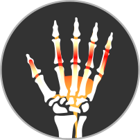 hand tendonitis icon